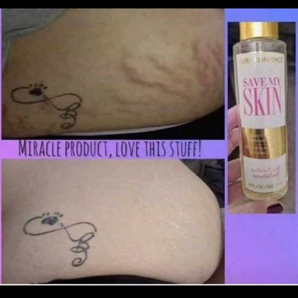 Save my Skin